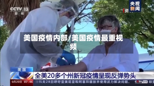 美国疫情内部/美国疫情最重视频-第2张图片