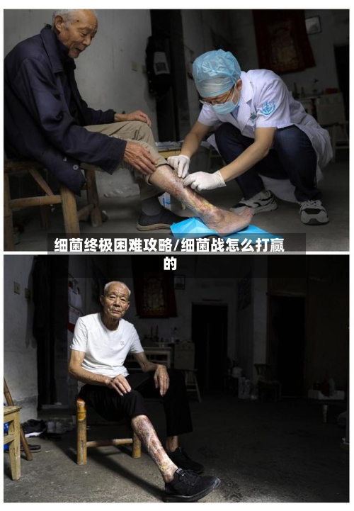 细菌终极困难攻略/细菌战怎么打赢的